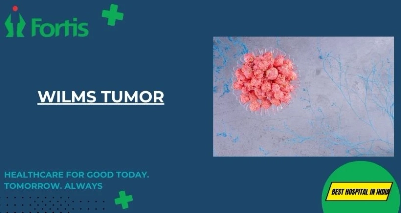 The Growing Need for ECMO Training: Why Hospitals Need Skilled Specialists for Extracorporeal Life Support