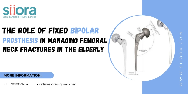 The Role of Fixed Bipolar Prosthesis in Managing Femoral Neck Fractures in the Elder
