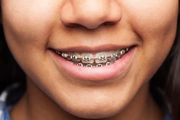 Champagne Braces vs. Traditional Metal Braces: What to Know