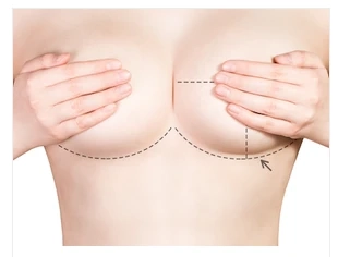 Tummy tuck Orlando procedure in USA