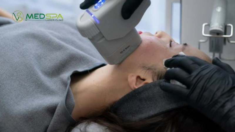 IPL Skin Treatment: Benefits, Costs, and What to Expect