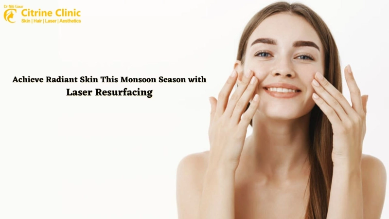 Achieve Radiant Skin This Monsoon Season with Laser Resurfacing