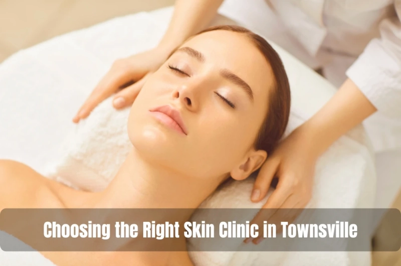 Choosing the Right Skin Clinic in Townsville