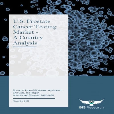 U.S. Prostate Cancer Testing Market is Anticipated to Reach $1,901.6 million in 2030