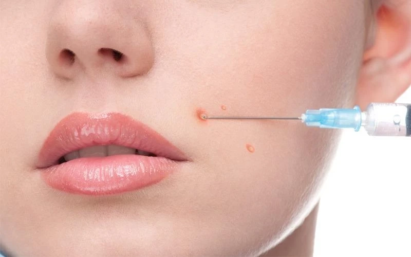 Glutathione Injections: Your Key to Glowing Skin in the Desert