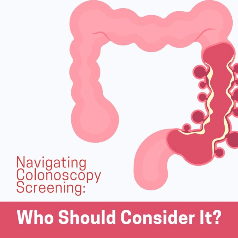 Navigating Colonoscopy Screening: Who Should Consider It?