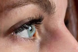 The Role of Intacs for Keratoconus in Vision Correction: What You Need to Know 