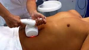 Redefine Hair Removal: Laser Treatments for a Silkier You Dubai