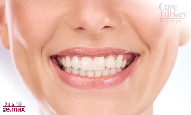 E-Max Crown Antalya: The Junction of Aesthetics and Durability