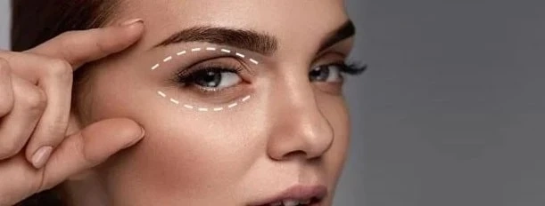 Upper and Lower Eyelid Blepharoplasty Surgery