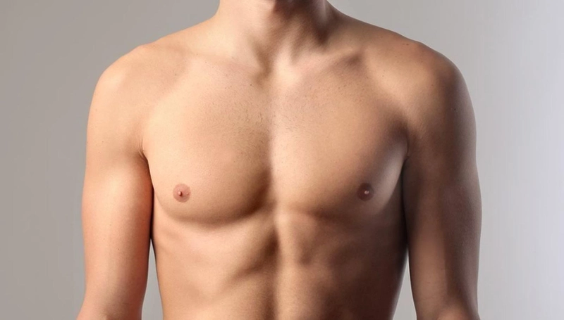 Gynecomastia in Men: A Comprehensive Guide to Treatment in Dubai