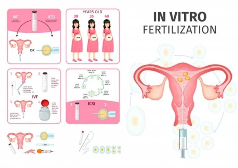 In vitro fertilization