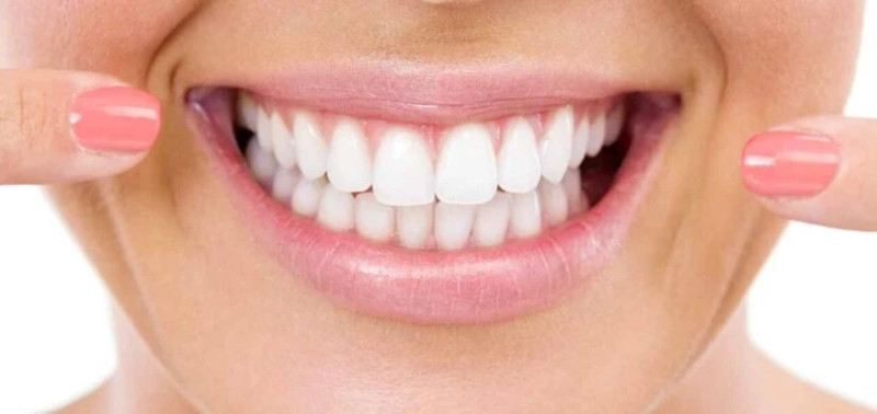 Is Teeth Whitening Possible for Older Adults with Yellow Teeth?