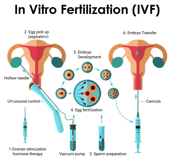 Get Free Consultation on Fertility Treatment at BabyScience IVF Clinics