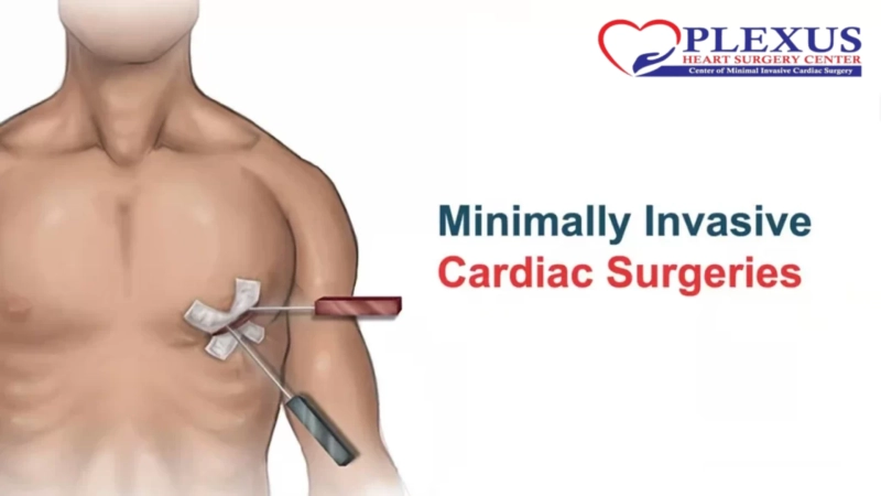 Open-Heart or Minimally Invasive Heart Surgery: Expert Guidance from the Best Cardiac Surgeon in India