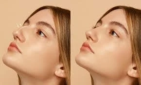 Monica General Hospital Plastic Surgery: Procedures, Safety Standards, and Patient Expectations