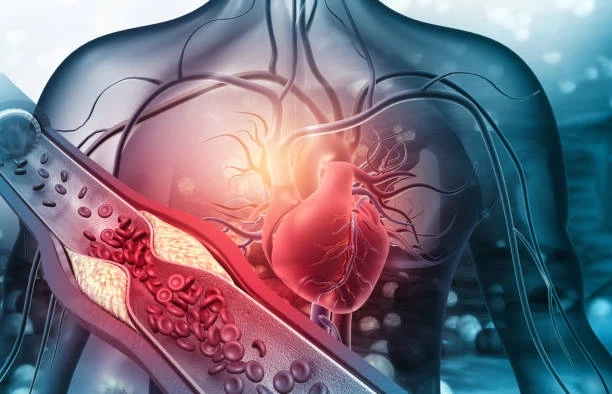 The Path to Heart Health Understanding Chest Discomfort Solutions