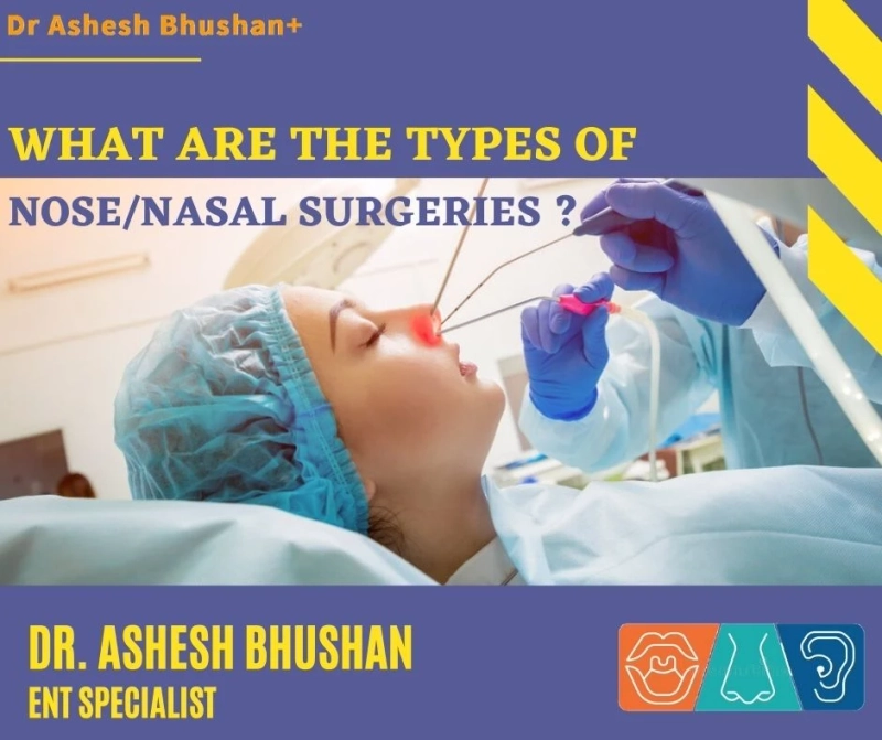 What are the types of nose/nasal  surgeries? Dr. Ashesh Bhushan