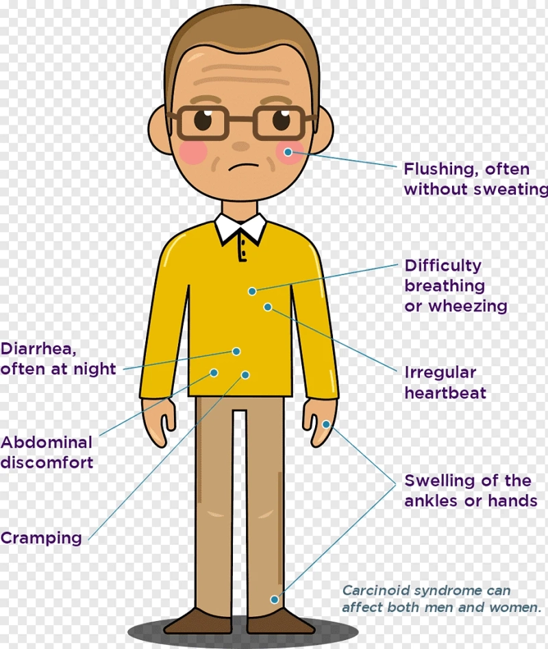 Natural Remedies for Carcinoid Syndrome Diarrhea Treatment