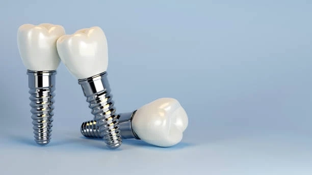 Zirconia Implants vs Traditional Implants: What Patients Should Know
