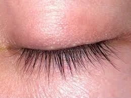 Secrets to Finding the Best Eyelid Surgery Doctor in Riyadh for Stunning Results