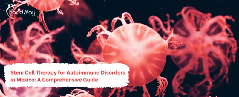Stem Cell Therapy for Autoimmune Disorders in Mexico: A Comprehensive Guide