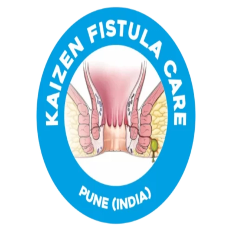 Perianal Abscess: Why Stage-Wise Surgical Treatment Gives Better Results