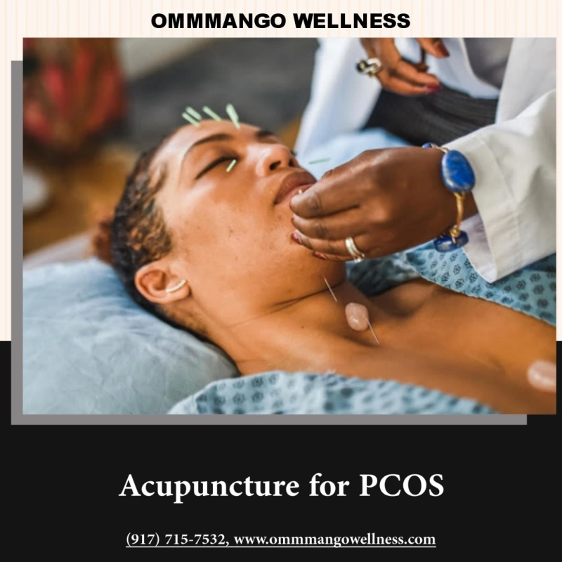 Acupuncture for PCOS