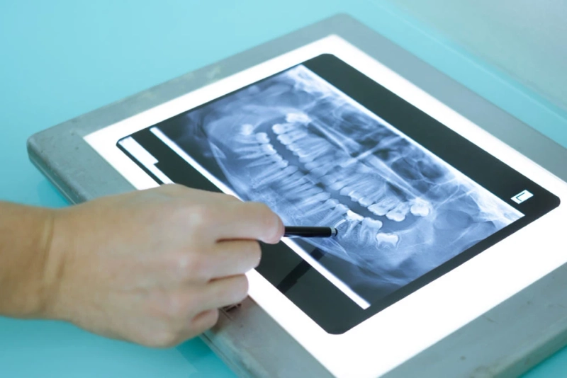 The Role of Technology in Modern Orthodontics in Winnipeg