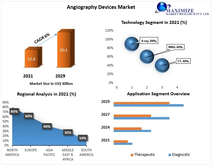 Angiography Devices Market by Manufacturers, Types, Regions and Application Research Report Forecast to 2029