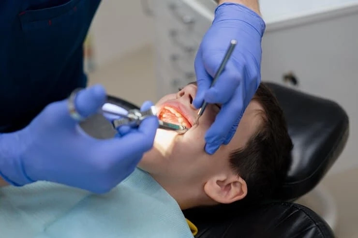 What to Expect During a Tooth Extraction in Powder Springs