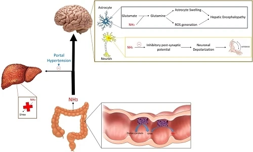 Forecasting 2020-2027: Global Hepatic Encephalopathy Market trends, share, size, growth, opportunities, and forecasts