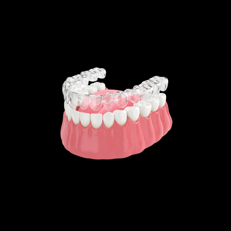 What to Expect During Your Invisalign Journey in Brisbane