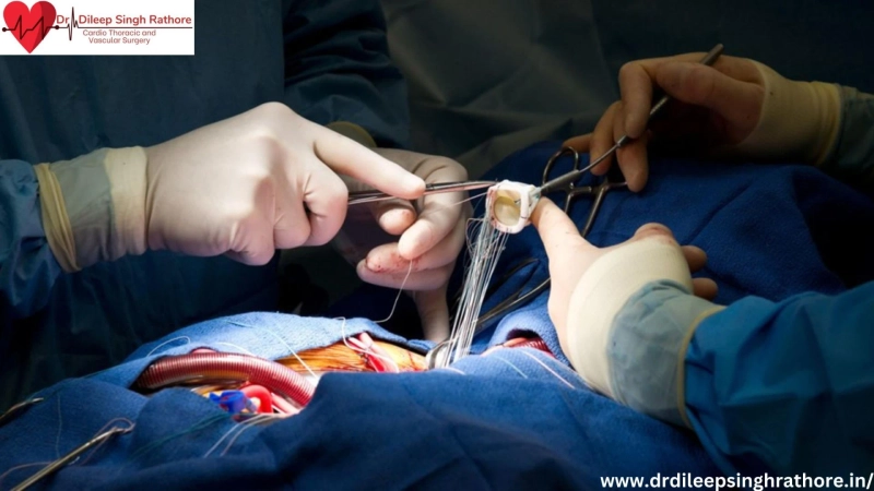 Best Cardiac Surgeon In Bhopal |Best Heart Surgeon In Bhopal :Dr. Dileep Singh