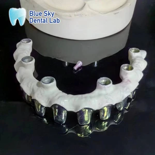 What Is a Malo Bridge Frame? Everything You Need to Know