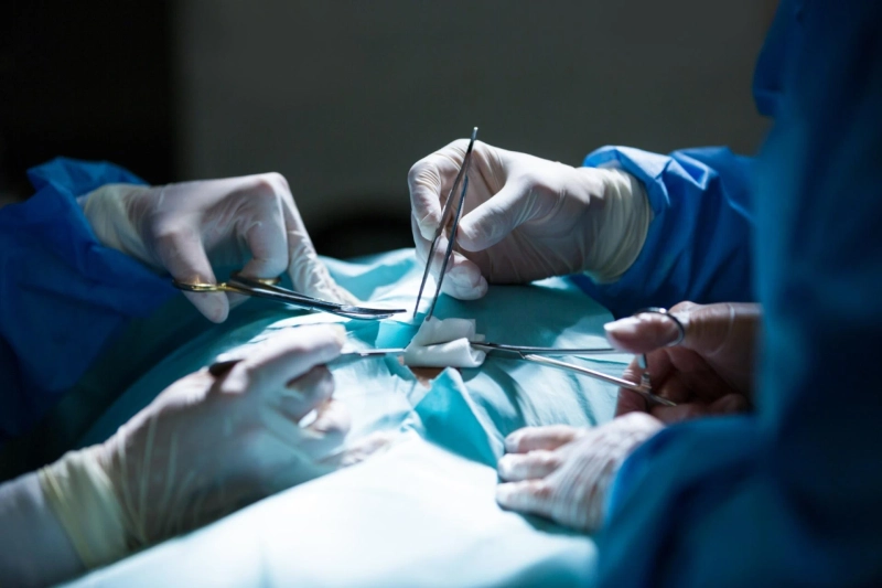Understanding Colorectal Surgery: Conditions, Procedures & Recovery