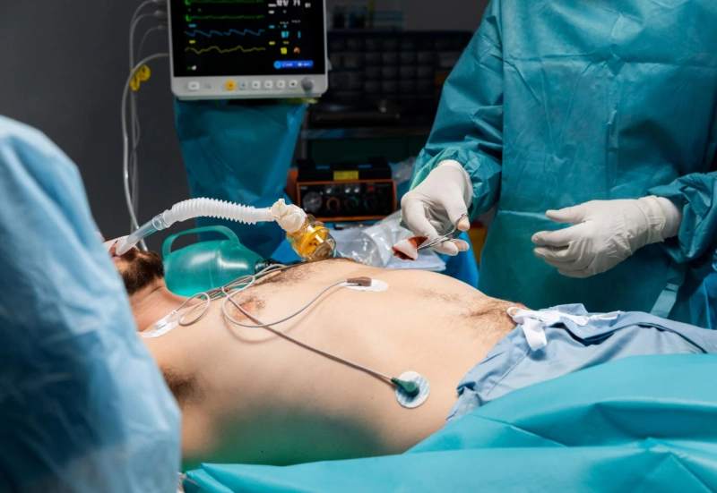 Gastrointestinal Cancer Surgery: When Is It Needed and What to Expect