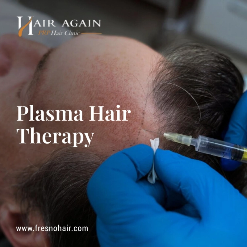 Unveiling the Benefits of PRP Hair Therapy in Fresno CA