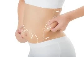 Slim Down with Science: Exploring Laser Fat Reduction in Saudi Arabia