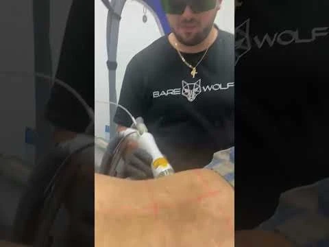 Men’s Laser Hair Removal Parramatta: Smooth, Confident Grooming for Men