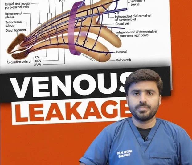 Venous Leak Treatment: A Complete Guide to Causes, Diagnosis & Best Modern Solutions