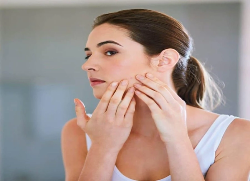 How Laser Treatment can help manage Acne Scars?