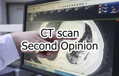 The Crucial Role of a Second Opinion in CT Scans