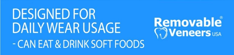 Snap-On Veneers for Teens and Young Adults: What Parents Should Know