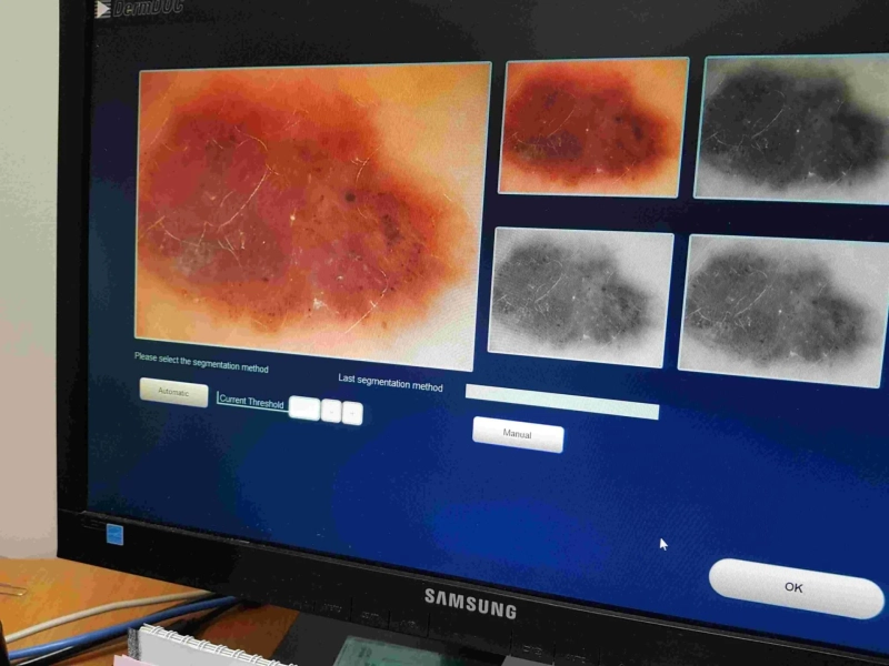Professional Skin Cancer Services At Rosebud | Medical Services