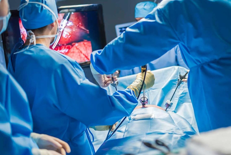 How Laparoscopic Surgery Reduces Recovery Time: A Closer Look
