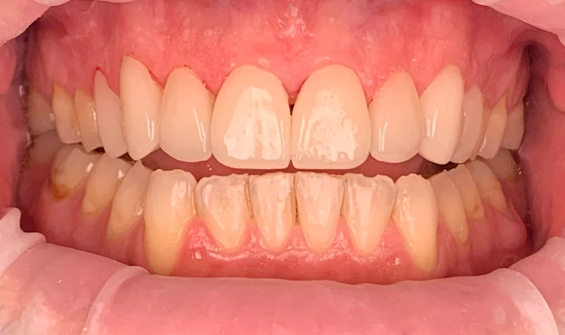 VIP Dental Implants Houston | Board-Certified Periodontist