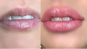 Aftercare for lip blush tattoo New York