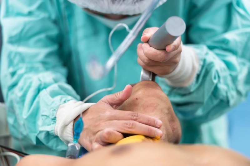 For patients who have difficulty breathing, the endotracheal tube is inserted through their mouths into the trachea.