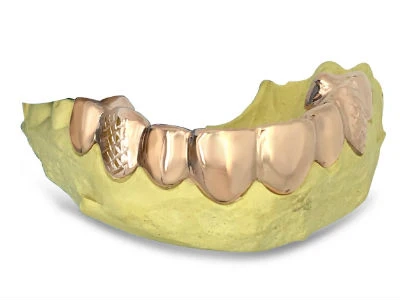 Shine with Confidence: Gold Grillz Las Vegas and Custom Jewelry